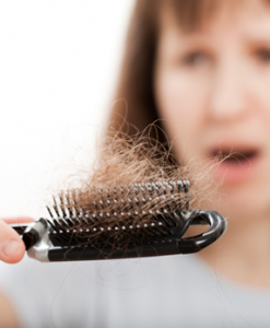 Female Hair Loss Female Hair Loss